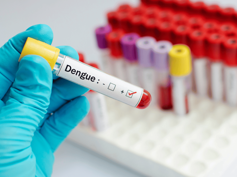 59 Dengue: Transmissão, Sintomas, Classificação e Condutas Essenciais para Profissionais de Saúde